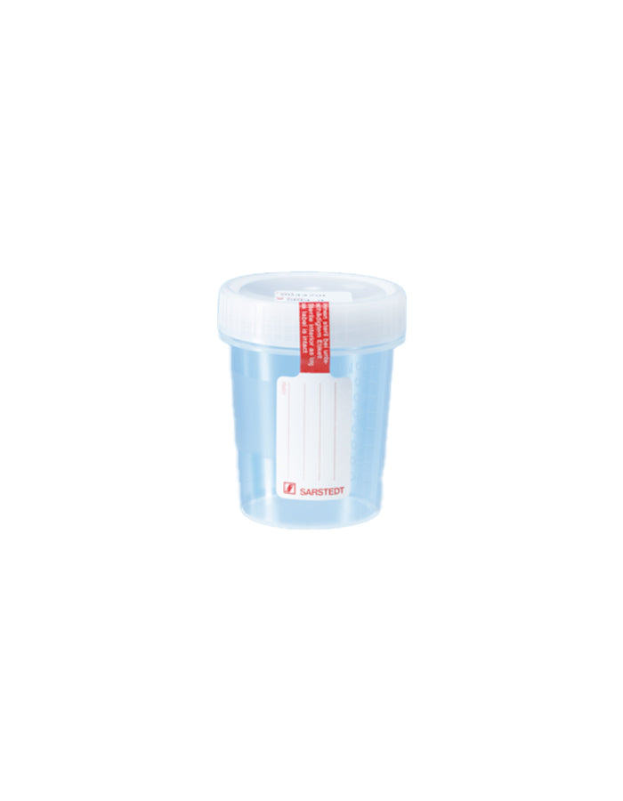 Schraubbecher für Urin, 100ml