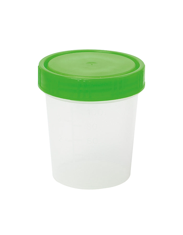 Urinbecher
